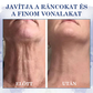 🔥 Utolsó nap a 70%-os kedvezményre 🌸 Fubsta® Fejlett feszesítő és ránctalanító krém: Helyreállítja a bőr rugalmasságát ⭐