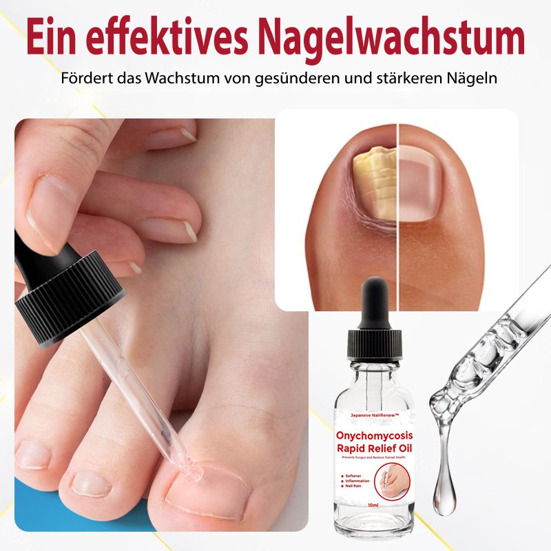 Japan NailRenew™ Onychomycosis Quick Relief Oil | 1+1 ZDARMA