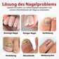 Japan NailRenew™ Onychomycosis Quick Relief Oil | 1+1 ZDARMA
